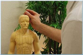 Bild: Akupunktur bei Hausarzt Dr. Rappold in Speyer